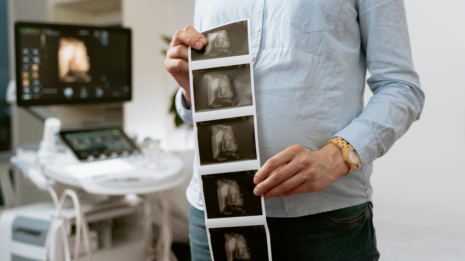 Fatty Liver Cases May Surge as Doctors Emphasise Diet Habits